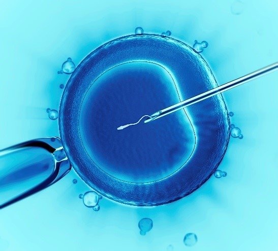 Microscopic image of a sperm being injected into an egg during the ICSI fertility procedure.