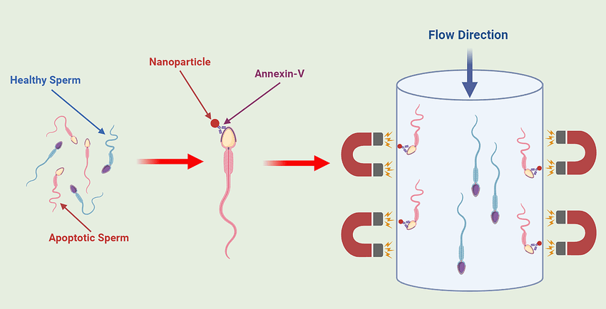 Illustration showing the separation of healthy and apoptotic sperm using nanoparticles and Annexin-V, followed by magnetic sorting inside a flow chamber.