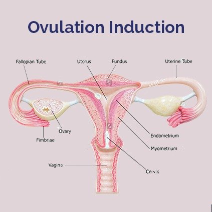 Medical illustration of the female reproductive system showing uterus, ovaries, fallopian tubes, endometrium, and cervix labeled for explaining ovulation induction.