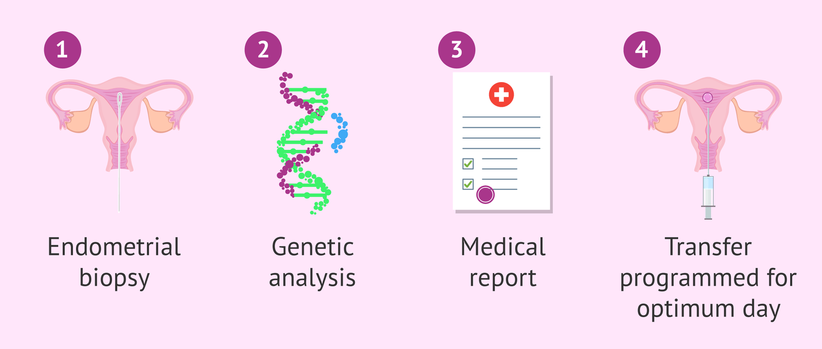 Illustration showing four steps of endometrial receptivity testing: endometrial biopsy, genetic analysis, medical report generation, and embryo transfer programmed for the optimum day.